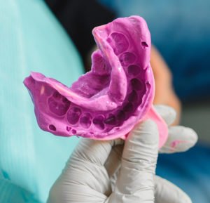 Proceso para la creación de una férula de descarga