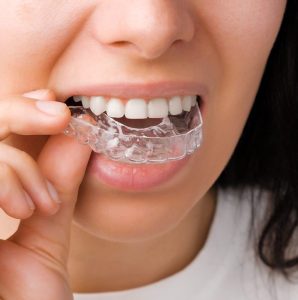 Ortodoncia especializada en San Sebastián de los Reyes